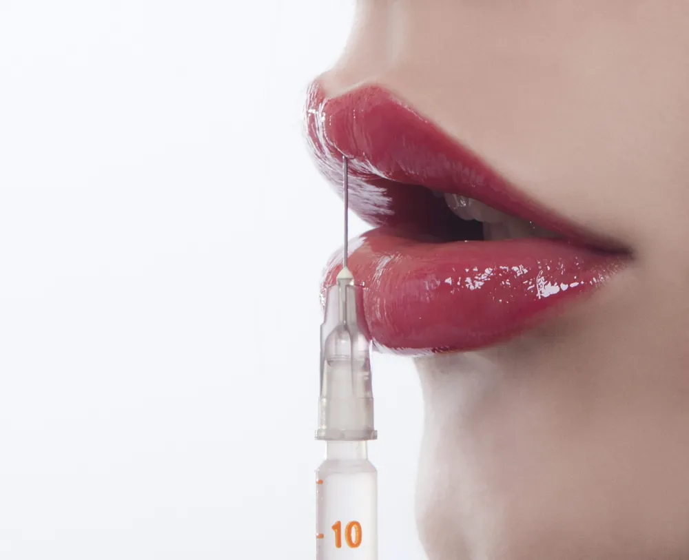 Aesthetic lip treatment with hyaluronic acid
